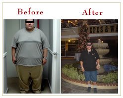 Slider image (7) Panama Gastric Surgery Center